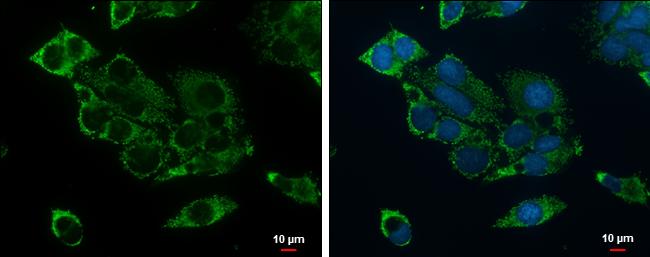 ACADSB Antibody - BSA Free
