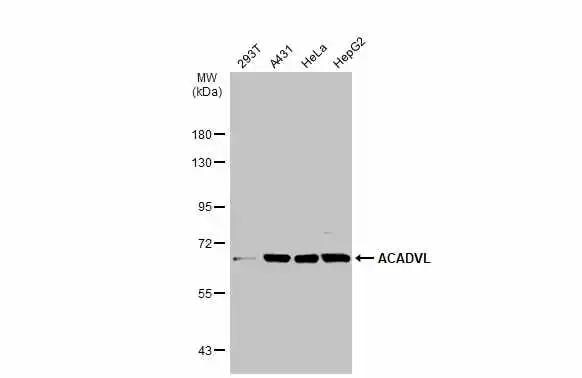 ACADVL Antibody