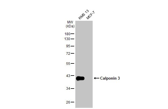 Acidic Calponin Antibody