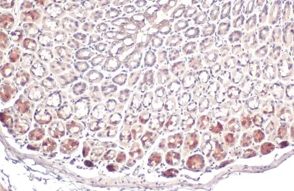 ACSL3 Antibody
