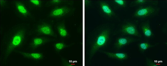 CapG Antibody