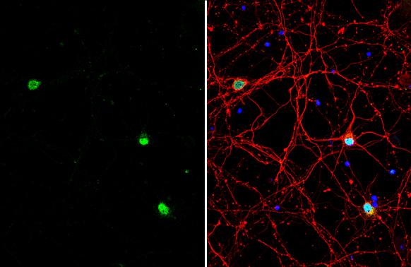ACTL6B Antibody - BSA Free