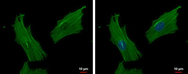 ACTR1B Antibody - BSA Free
