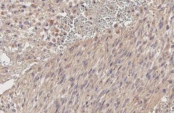 ADAM10 Antibody