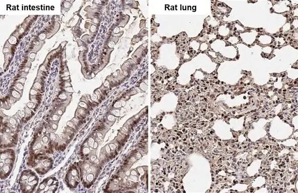ADK Antibody