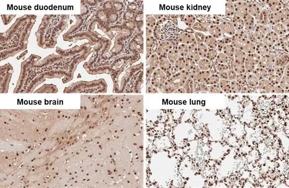 ADK Antibody