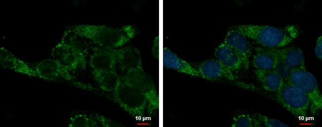 ADHFE1 Antibody - BSA Free