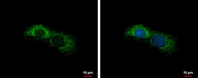 ALDH7A1 Antibody