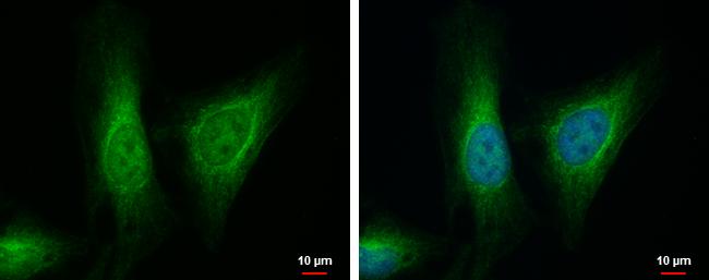 ALDH7A1 Antibody - BSA Free