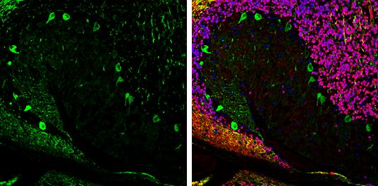 Aldolase C Antibody