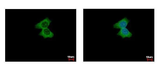 Alpha Actinin 4 Antibody