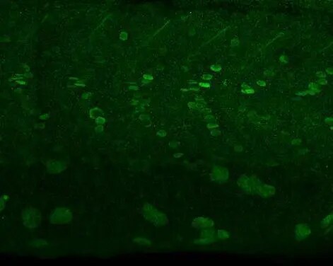 alpha Adducin Antibody