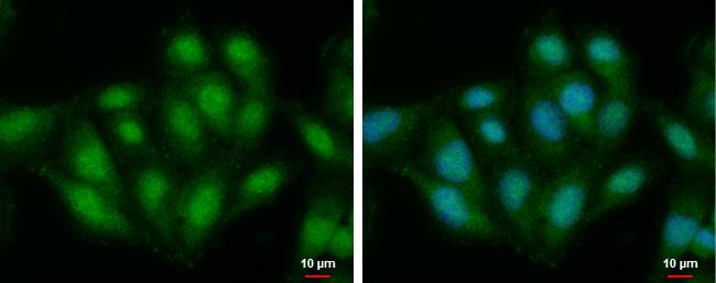 ALS2CR3 Antibody