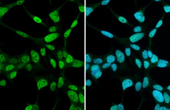 Androgen R/NR3C4 Antibody