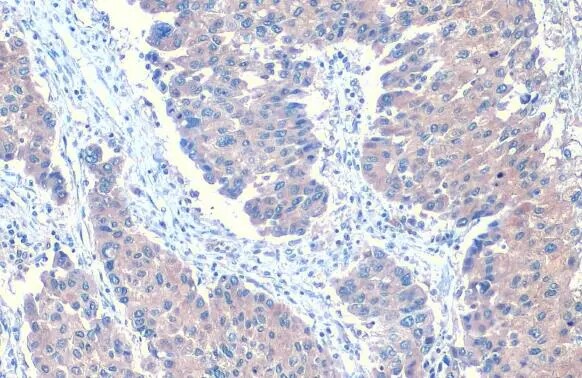 Angiopoietin-like Protein 3/ANGPTL3 Antibody