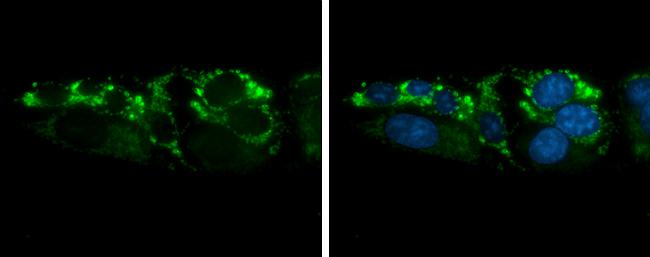 ARG2 Antibody - BSA Free