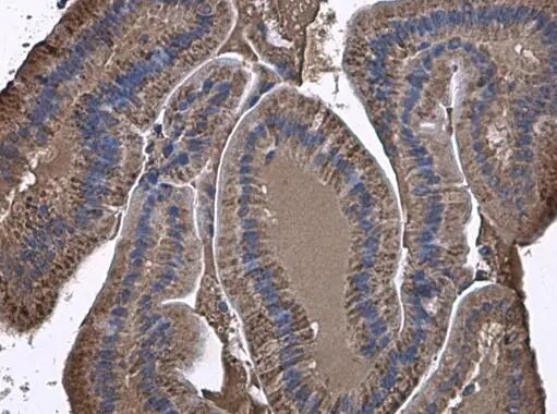 ARG2 Antibody