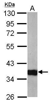 ARPC1A Antibody