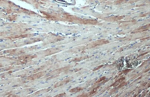 ASAH1 Antibody