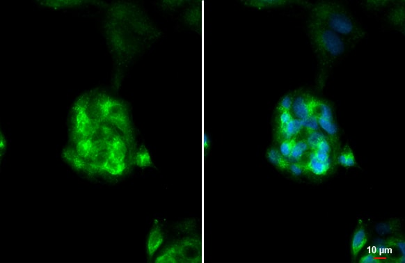 ASGPR1 Antibody