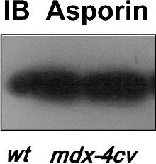 Asporin Antibody