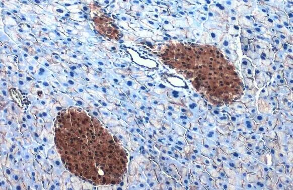 ATP Citrate Lyase Antibody