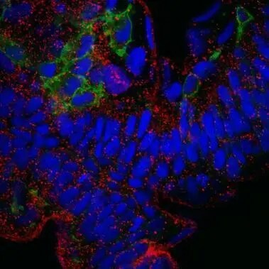 ATP6V0D1 Antibody