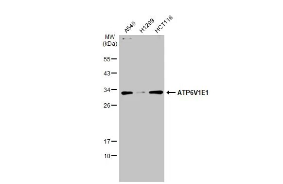 ATP6V1E1 Antibody