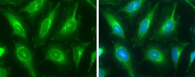 ATP6V1E1 Antibody