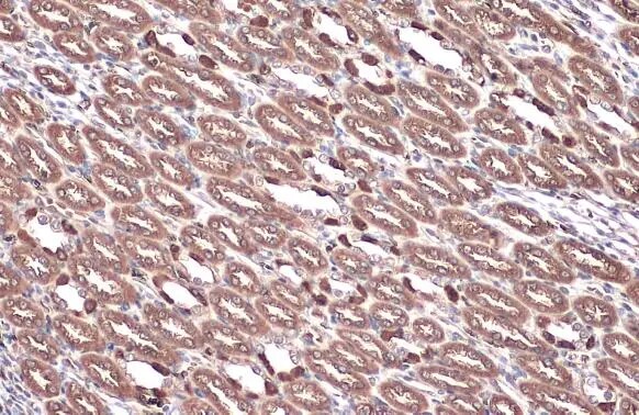 ATP6V1E1 Antibody