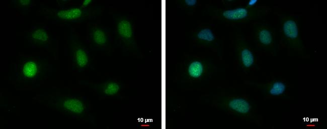 BAT3/BAG6 Antibody