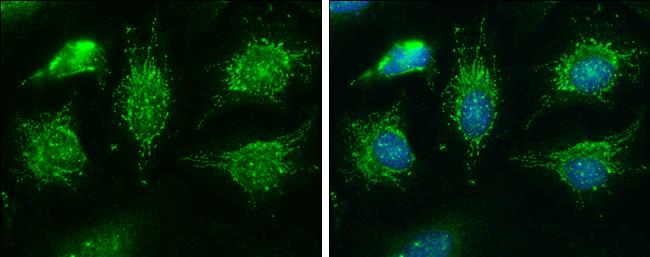 BCKDHA Antibody