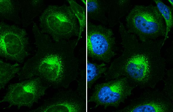 beta 2-Microglobulin Antibody