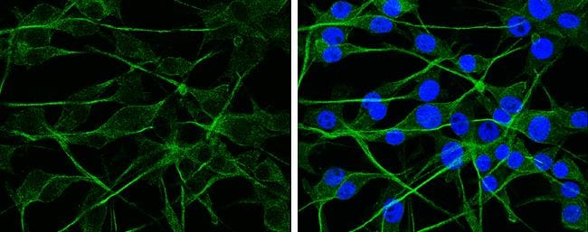 APP Antibody - BSA Free