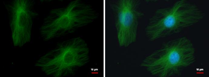 beta II Tubulin A Antibody