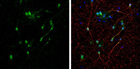 BNIP2 Antibody