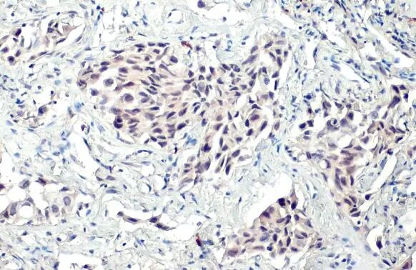BRD1 Antibody