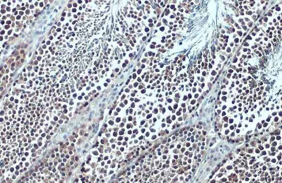 BRD3 Antibody