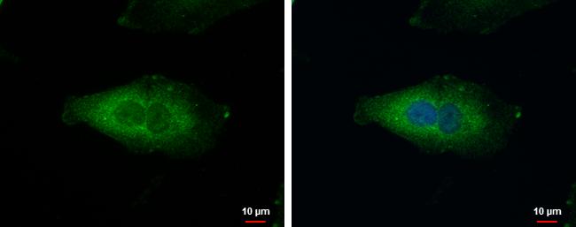 NDUFAF5 Antibody - BSA Free