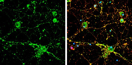 Calcineurin A Antibody