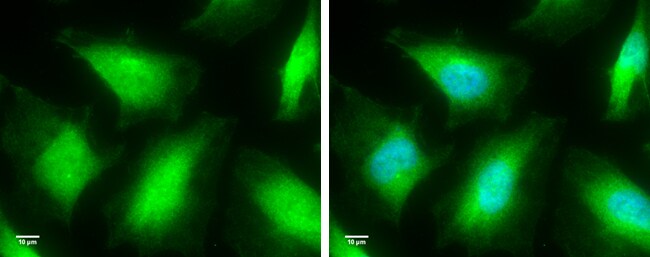 Caspase-8 Antibody