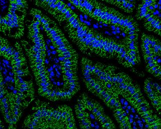 Catenin alpha 1 Antibody - BSA Free