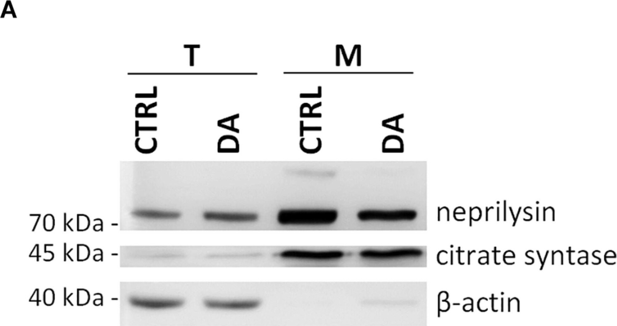 Neprilysin/CD10 Antibody - BSA Free