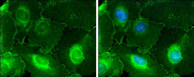 MCAM/CD146 Antibody - Azide Free