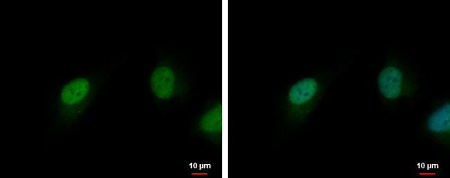 Cdk6 Antibody