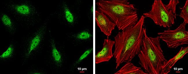 Cdk9 Antibody