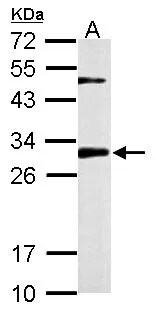 CHMP2B Antibody