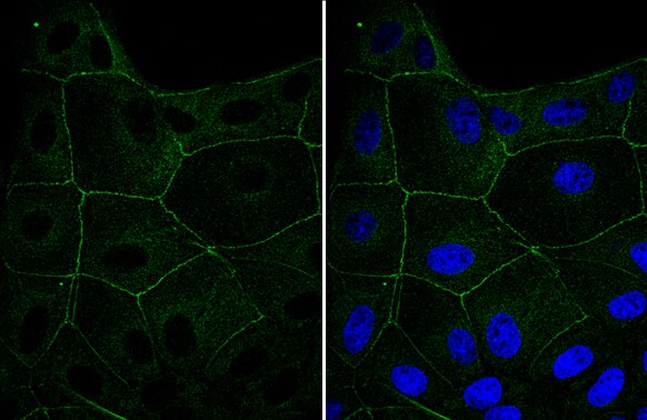 Cingulin Antibody