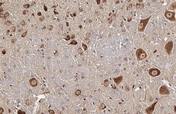 CKAP4/p63 Antibody