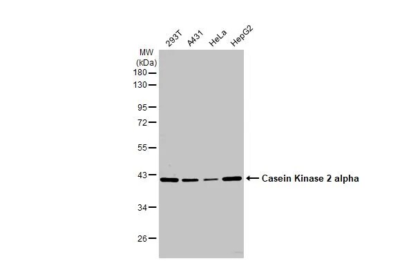 Casein Kinase 2 alpha Antibody